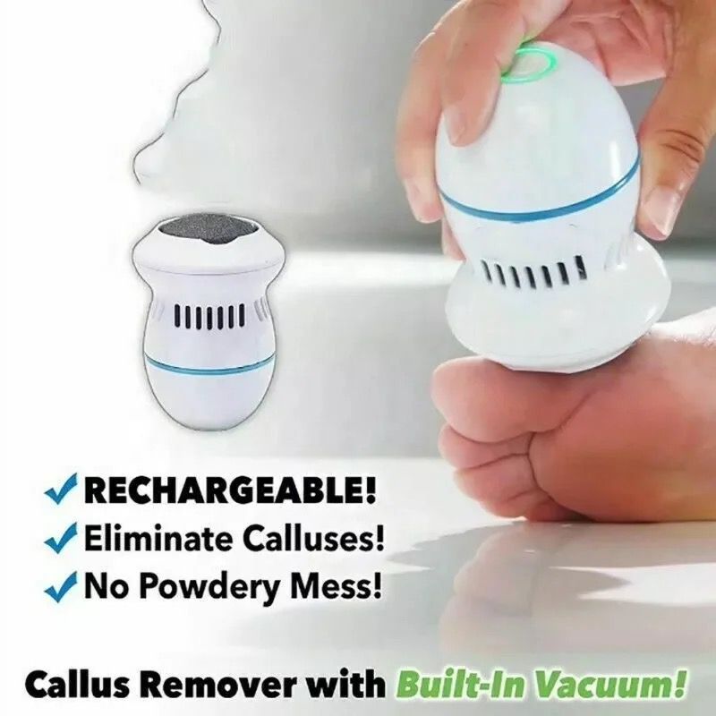 Removedor de Callos Recargable (311487)