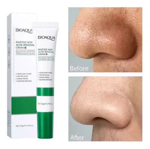 Crema Ácido Salicílico Bioaqua (1174130)